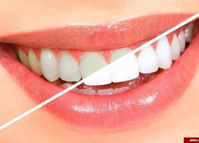 سفید کردن دندان ها بدون احتیاج به دندانپزشک، با 7 فرمول طبیعی دندان هایتان مثل مروارید می درخشد