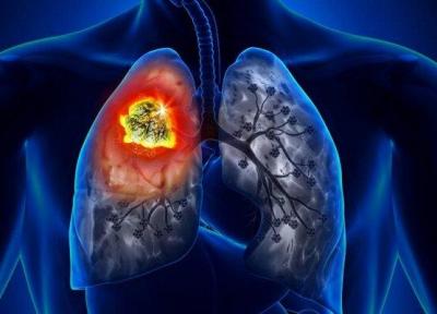سیستم ایمنی معیوب منجر به سرطان ریه می گردد