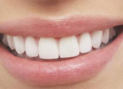 سفید کردن دندان با خوردن 4 خوراکی طبیعی
